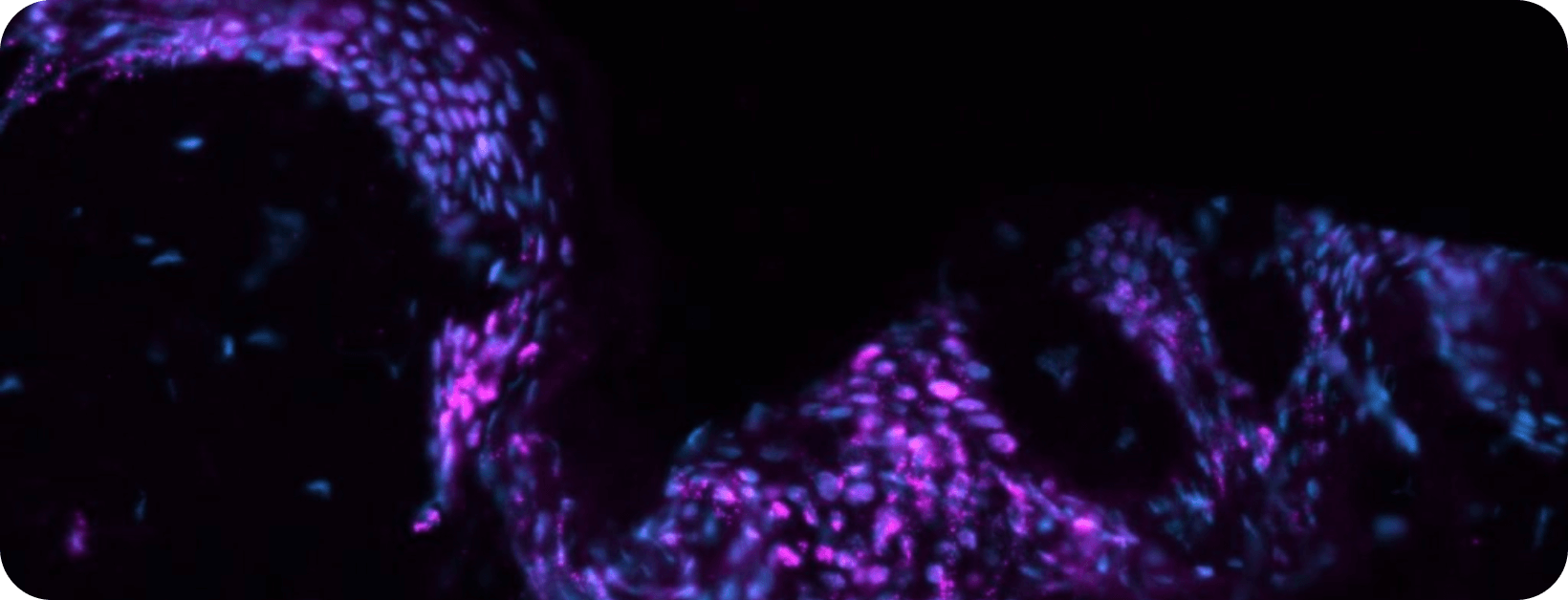 Skin Biopsies